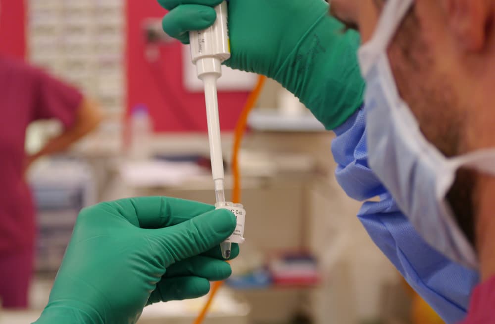 Cartilage cells being loaded onto a scaffold in theatre at London Cartilage Clinic