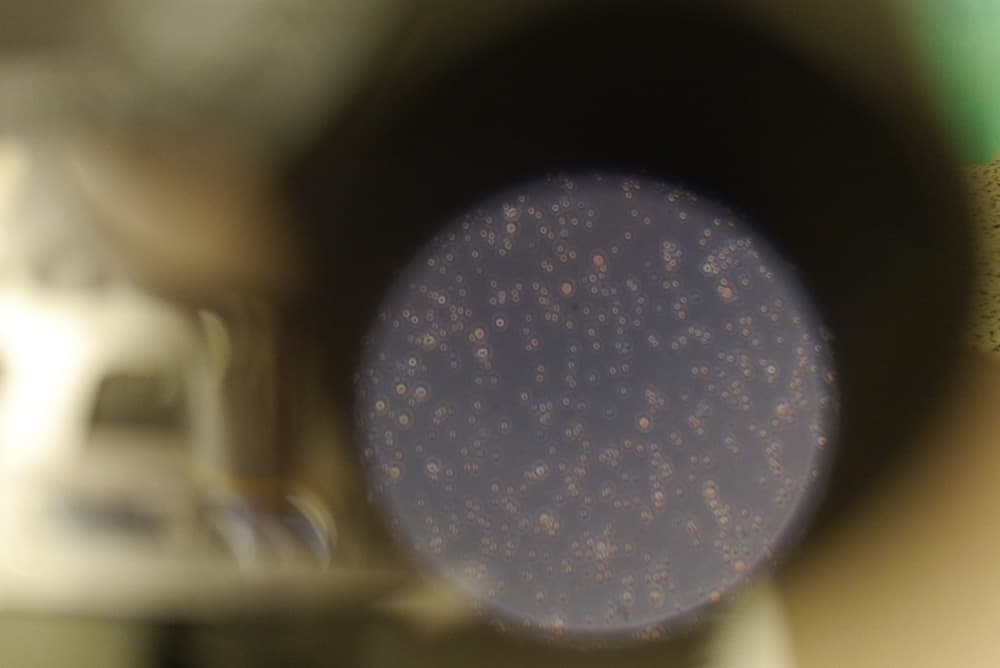 Cartilage cells on a scaffold prepared at London Cartilage Clinic