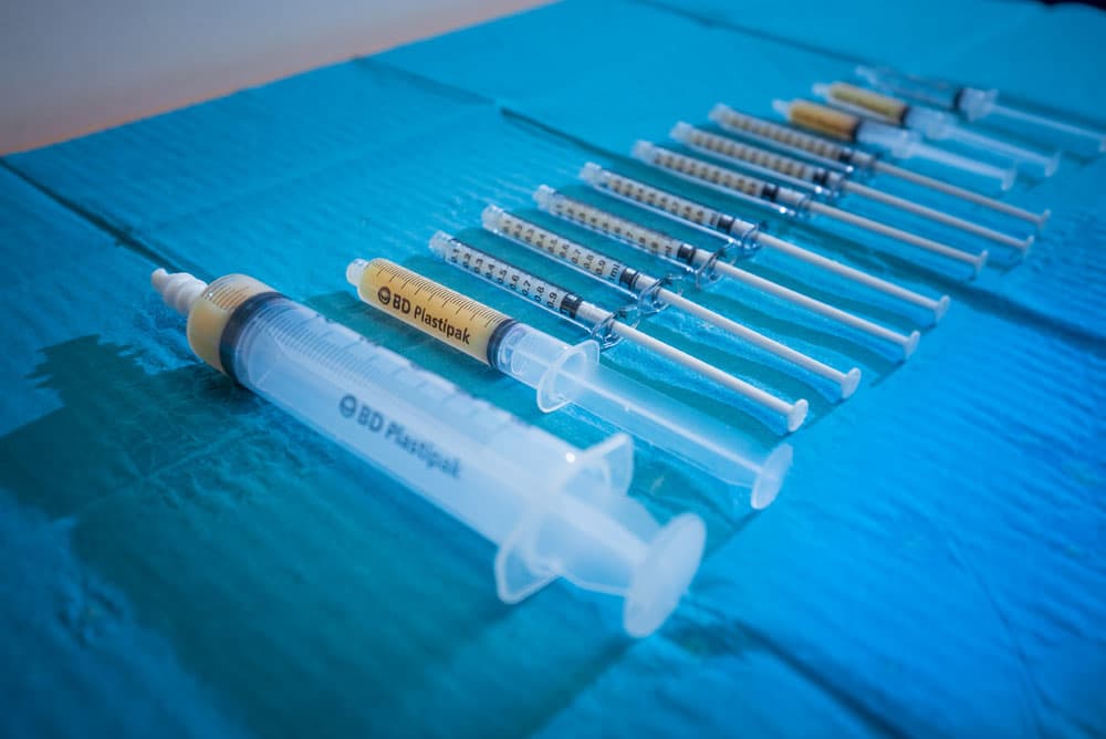 Professor Lee preparing a regenerative joint injection