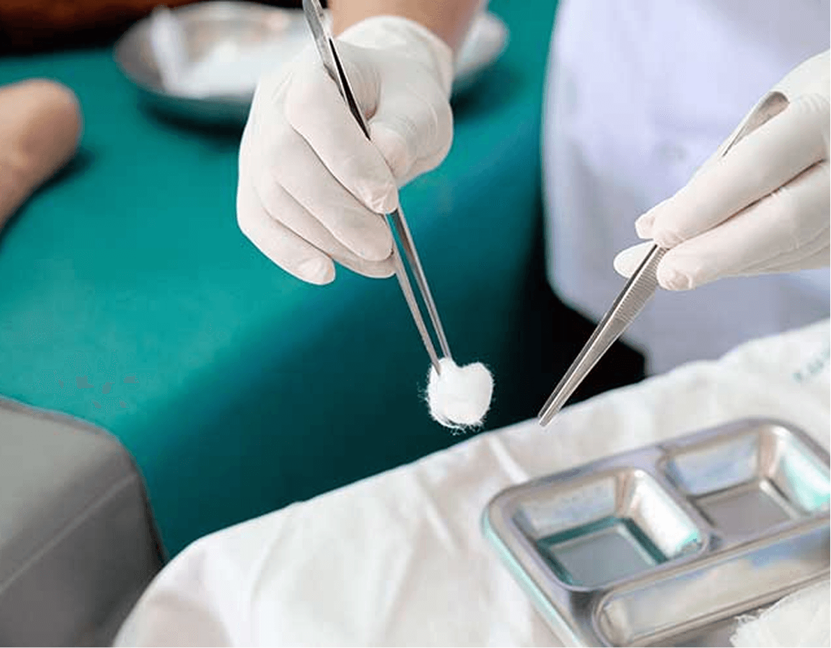 Gloved hands using surgical tweezers during a sterile procedure